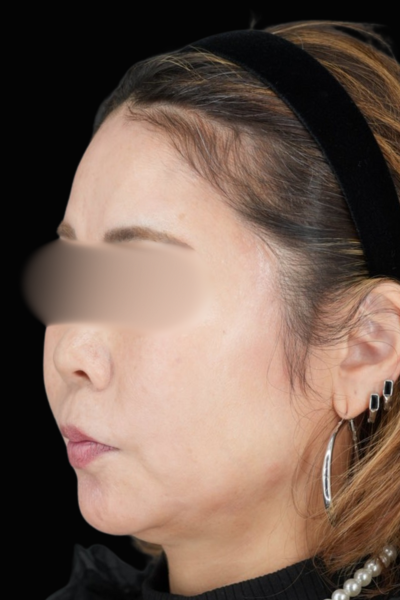 手術前の状態 その1