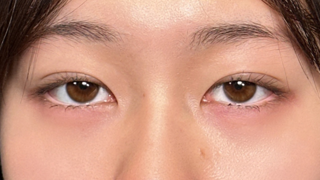 Postoperative Condition Part 1