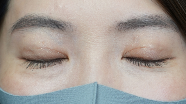 Postoperative Condition Part 1