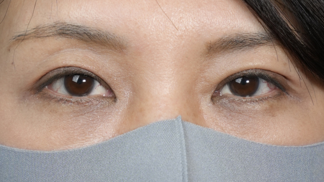 Postoperative Condition Part 1