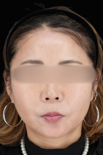 手術前の状態 その1