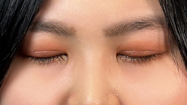 Postoperative Condition Part 1