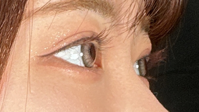 Postoperative Condition Part 1