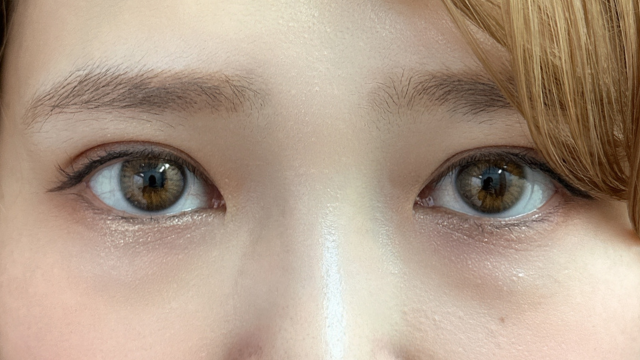 Postoperative Condition Part 1