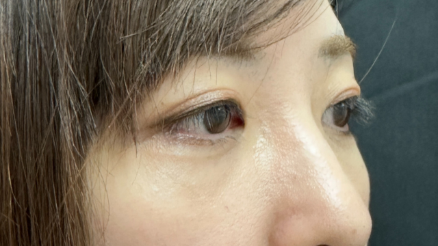 Postoperative Condition Part 1