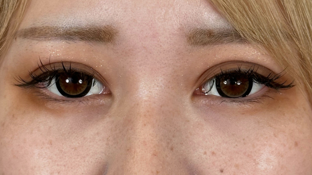 Postoperative Condition Part 1