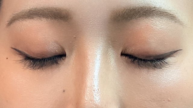 Postoperative Condition Part 1