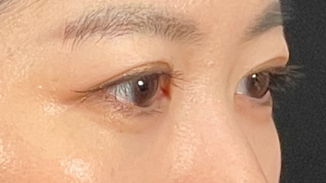 Postoperative Condition Part 1