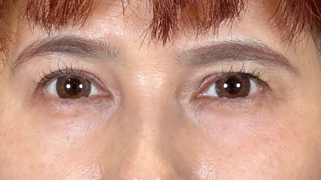 Postoperative Condition Part 1