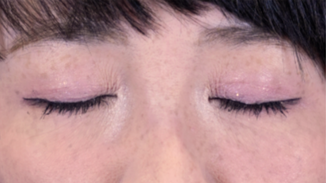 Postoperative Condition Part 1