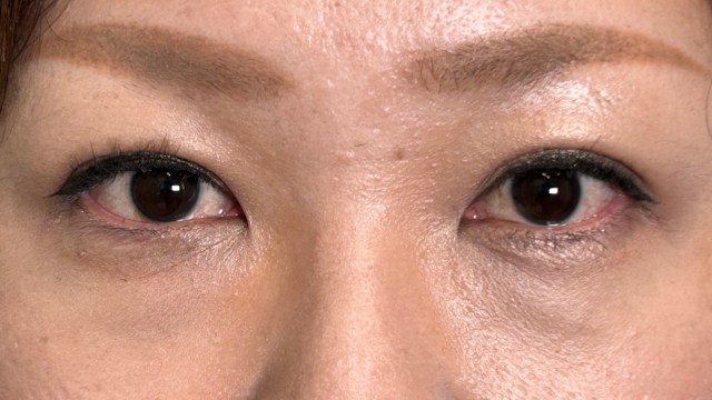 Postoperative Condition Part 1