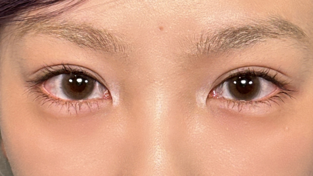 Postoperative Condition Part 1