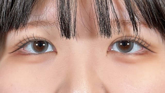 Postoperative Condition Part 1