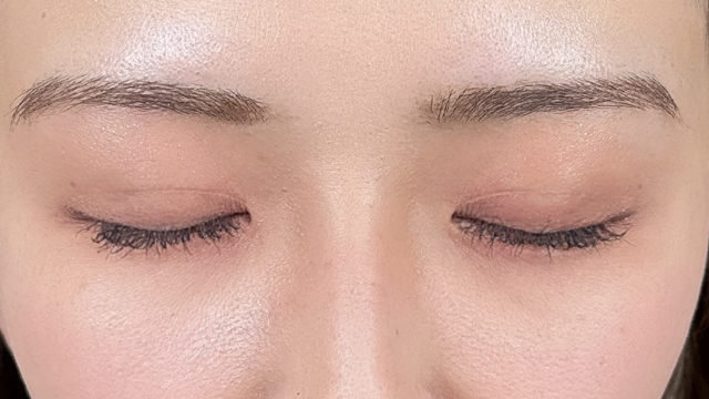 Postoperative Condition Part 1