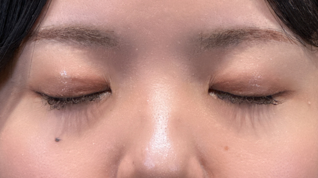 Postoperative Condition Part 1