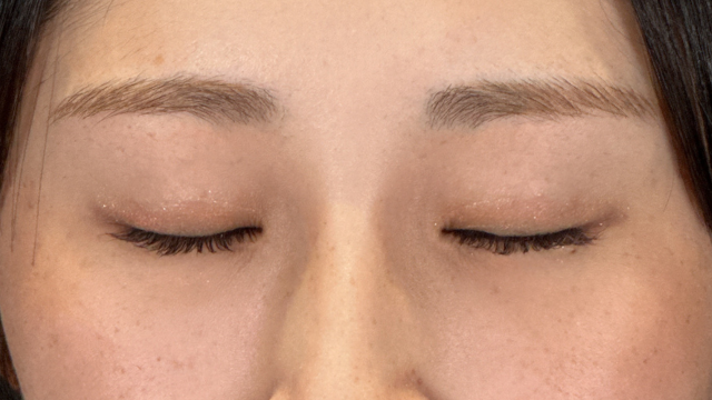 Postoperative Condition Part 1