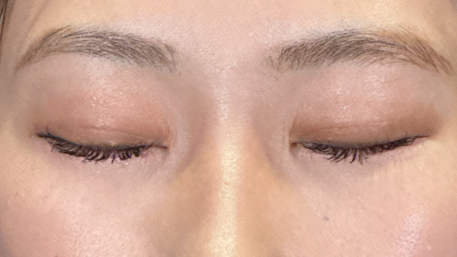 Postoperative Condition Part 1