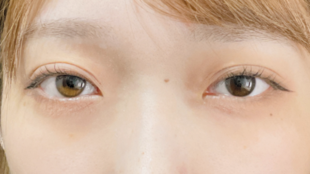 Postoperative Condition Part 1