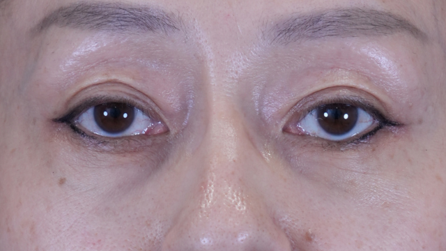 Postoperative Condition Part 1