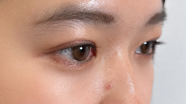 Postoperative Condition Part 1