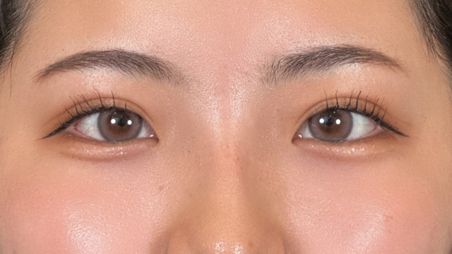 Postoperative Condition Part 1