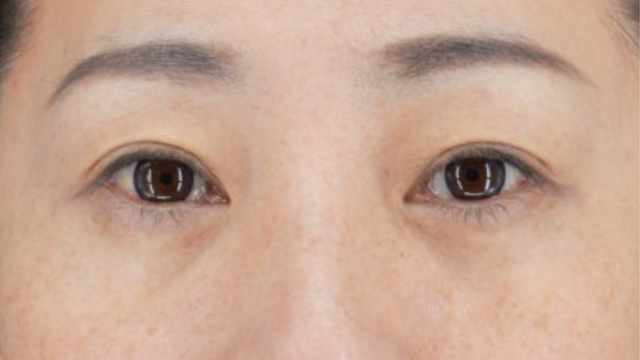 Postoperative Condition Part 1