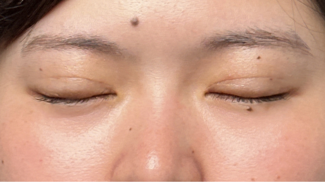 Postoperative Condition Part 1