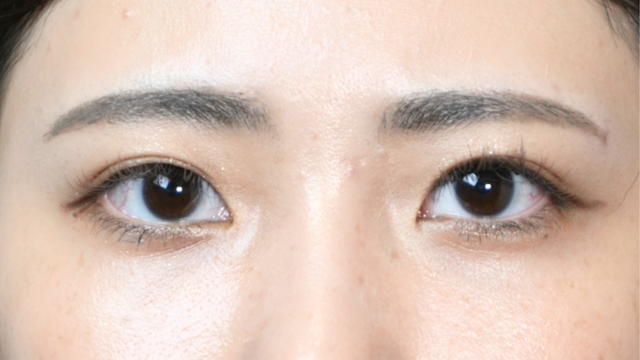 Postoperative Condition Part 1