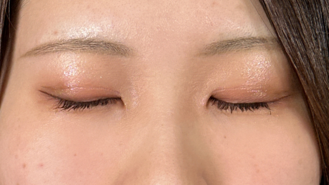 Postoperative Condition Part 1