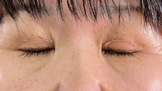 Postoperative Condition Part 1