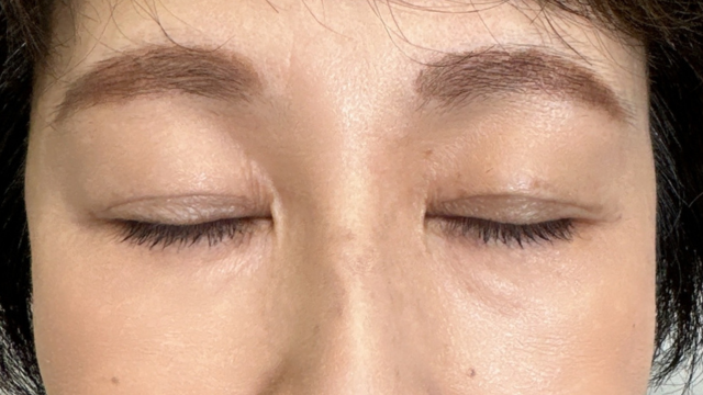 Postoperative Condition Part 1