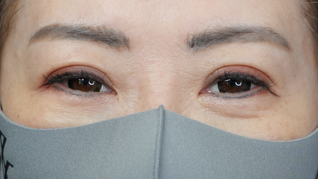 Postoperative Condition Part 1