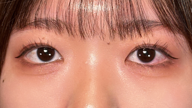 Postoperative Condition Part 1