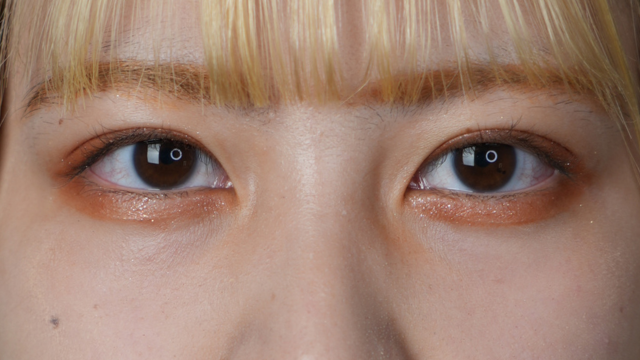 Postoperative Condition Part 1