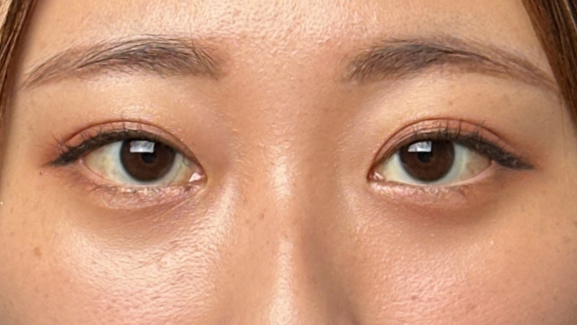 Postoperative Condition Part 1