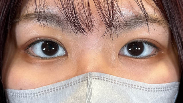 Postoperative Condition Part 1