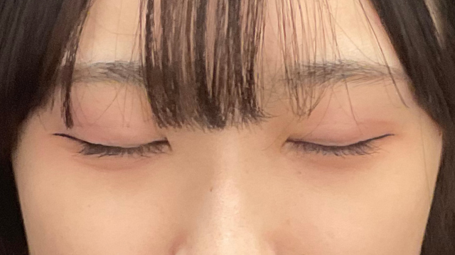 Postoperative Condition Part 1