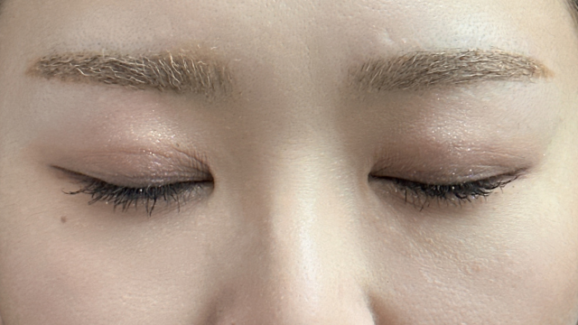 Postoperative Condition Part 1