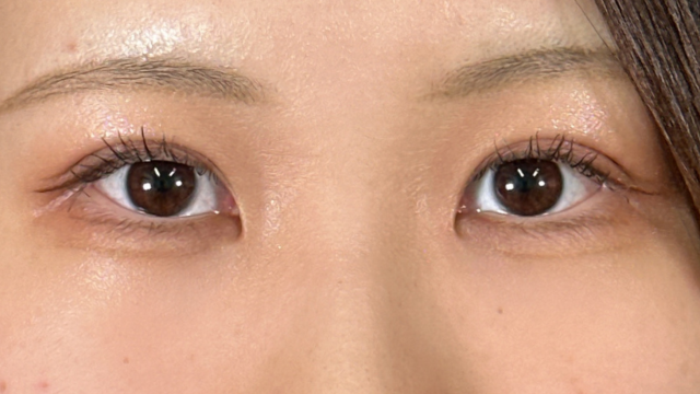 Postoperative Condition Part 1