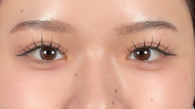 Postoperative Condition Part 1