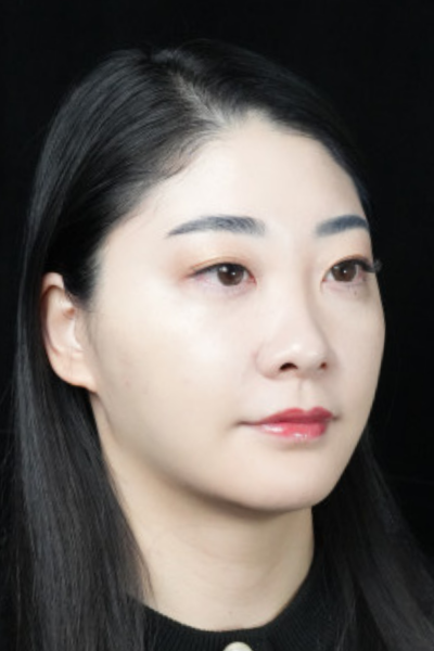 手術前の状態 その1