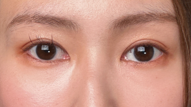 Postoperative Condition Part 1