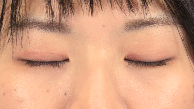 Postoperative Condition Part 1