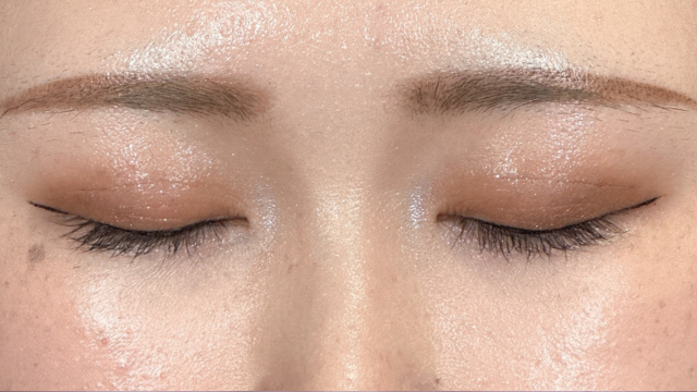 Postoperative Condition Part 1