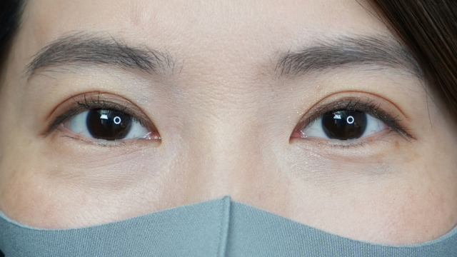 Postoperative Condition Part 1