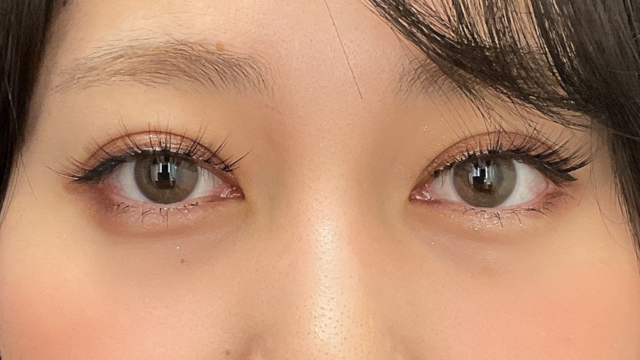 Postoperative Condition Part 1