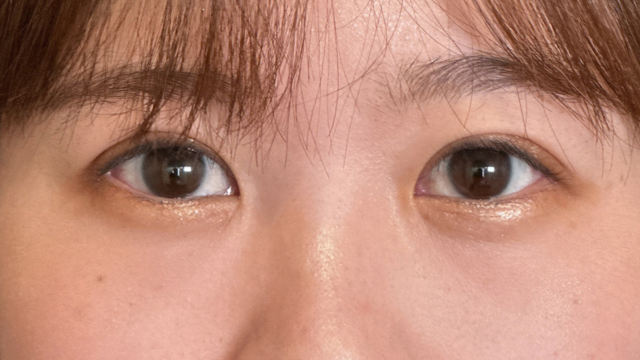 Postoperative Condition Part 1