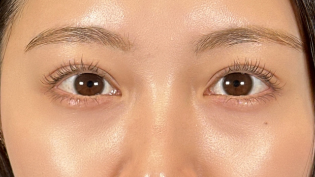 Postoperative Condition Part 1