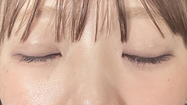 Postoperative Condition Part 1