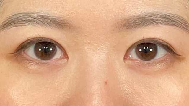 Postoperative Condition Part 1